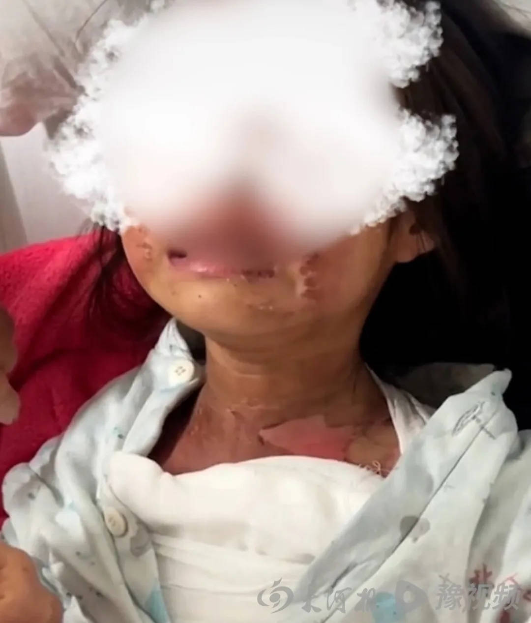 广东被高年级男生泼开水女童已返校<strong></p>
<p>国金证券招聘</strong>，家长称多人被处理