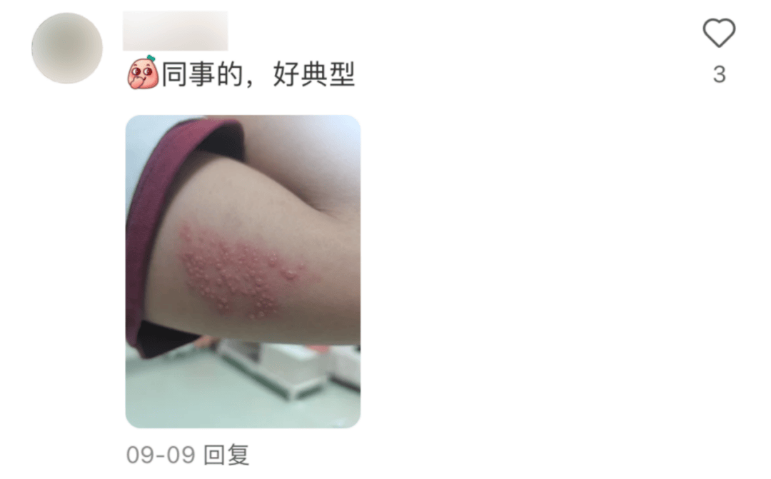 一旦感染终身携带<strong></p>
<p>搜狐证券</strong>！深圳疾控提醒：这4类人要注意