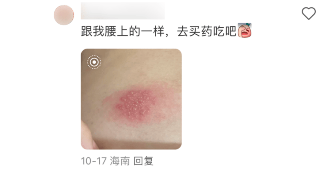 一旦感染终身携带<strong></p>
<p>搜狐证券</strong>！深圳疾控提醒：这4类人要注意