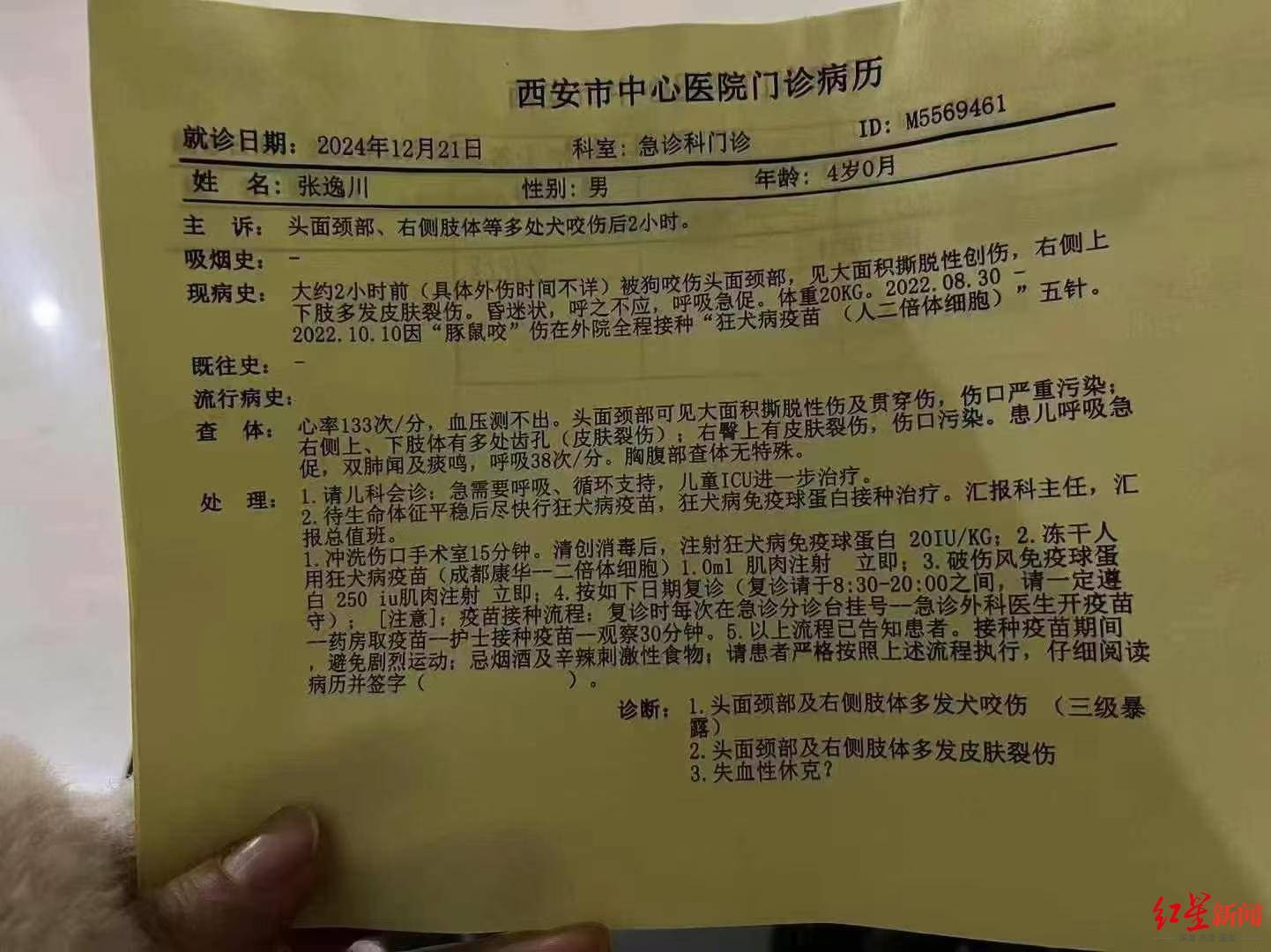 西安4岁男童遭恶犬袭击<strong></p>
<p>安信证券股份有限公司</strong>，致脸部大面积创伤，目前仍在ICU昏迷 警方已在调查犬只来源