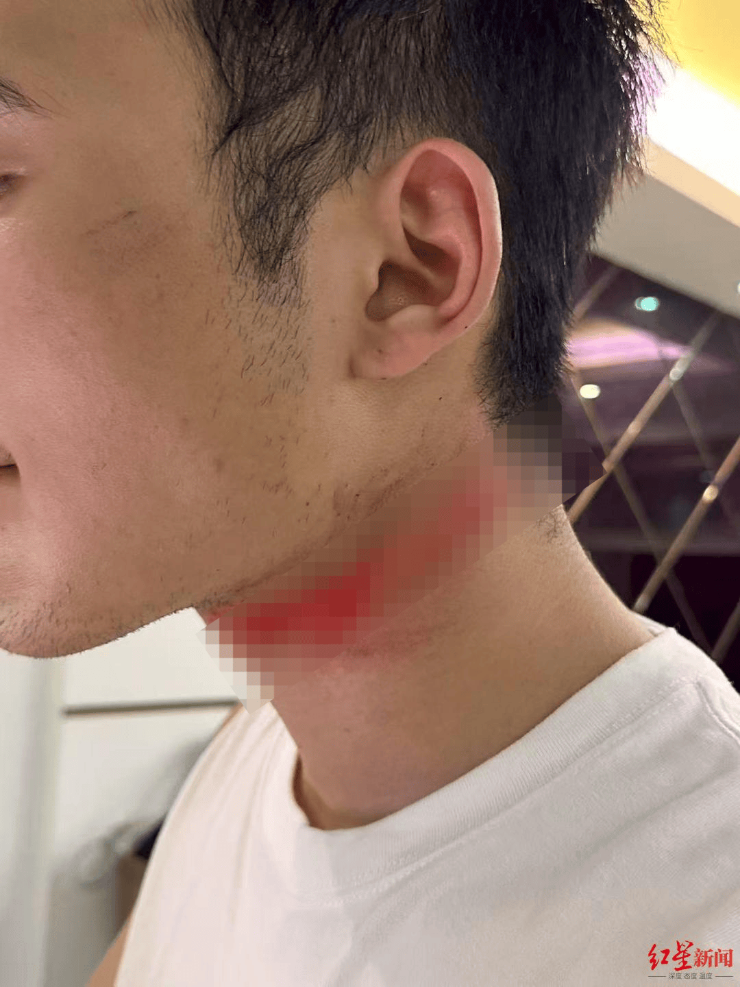 男主播骑车载女友回家被路边掉落网线勒伤脖子<strong></p>
<p>IPFS交易app</strong>，索赔3万陷僵局 律师解读该谁赔