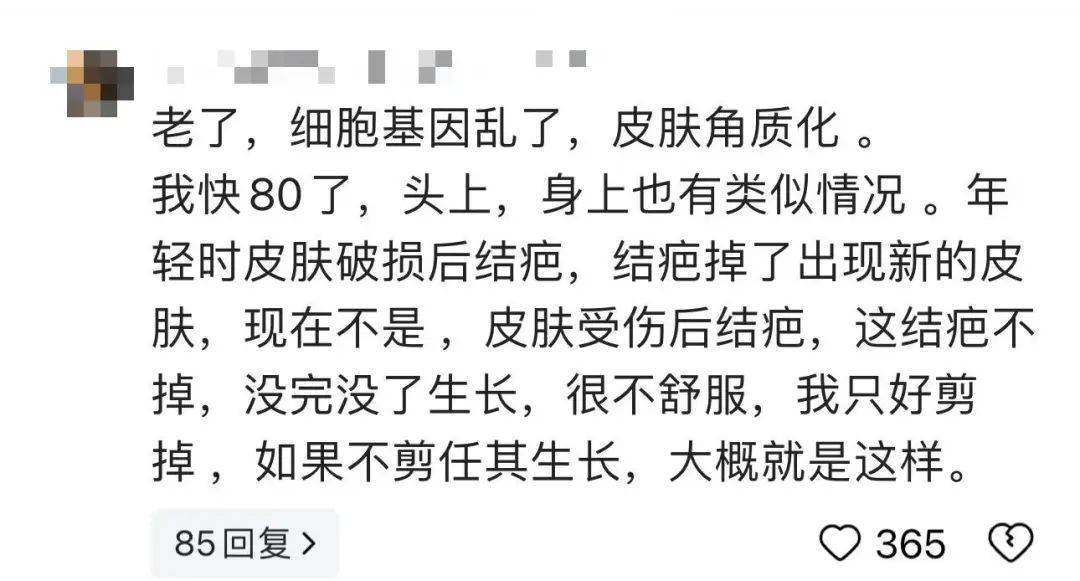太狠了！98岁阿婆拿起剪刀<strong></p>
<p>火币交易平台</strong>，对准自已一刀下去…后果很严重！