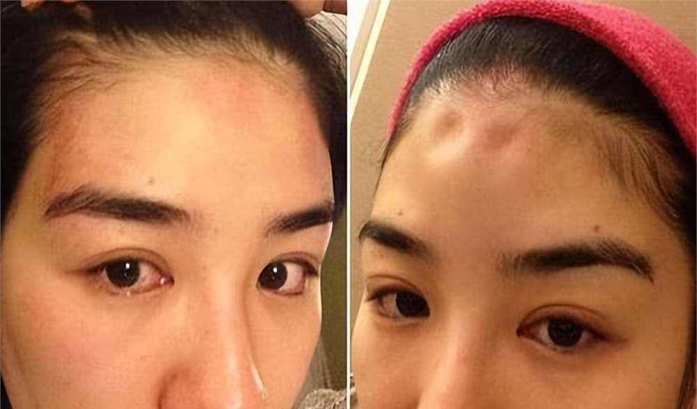 罗霖被家暴17年<strong></p>
<p>BCH交易平台</strong>，蓝洁瑛遭性侵暴力还被围观！女明星的暴力事件还有很多
