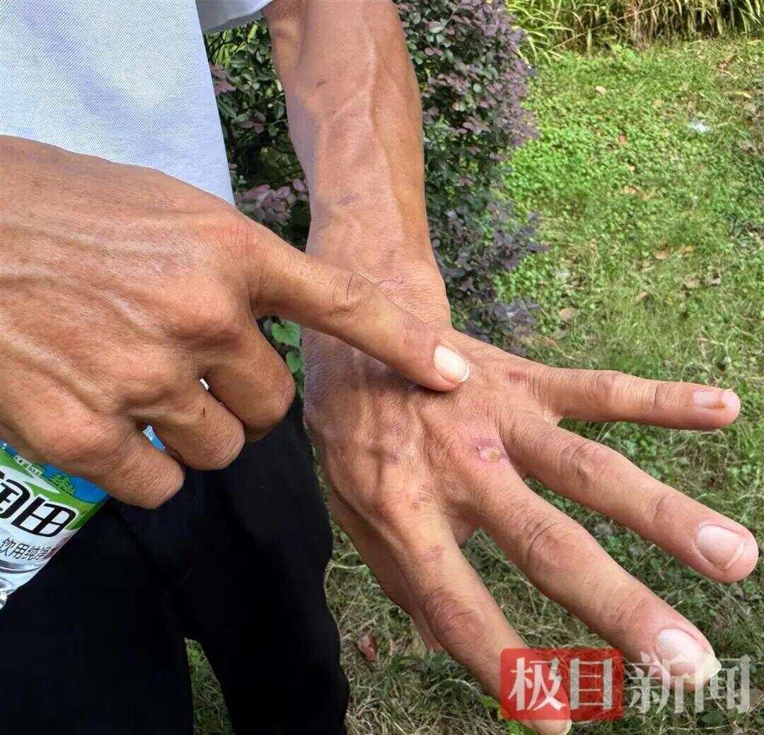 生意爆火赚得盆满钵满<strong></p>
<p>LTC交易平台</strong>？鸡排哥谈收入笑称“还没赚到1个亿”